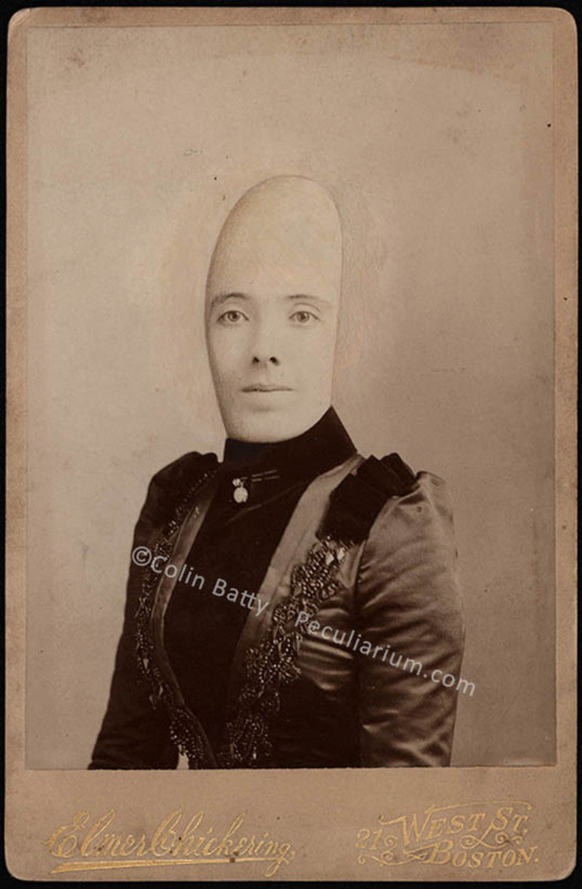 Thumb Headed Lady PRINT from Colin Batty's original Cabinet Card Collection.