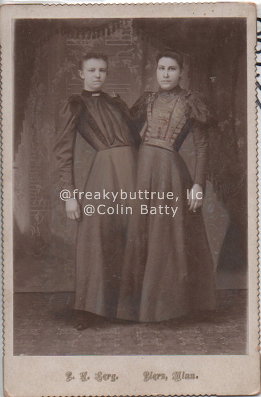 Conjoined Twin Women Print by Colin Batty