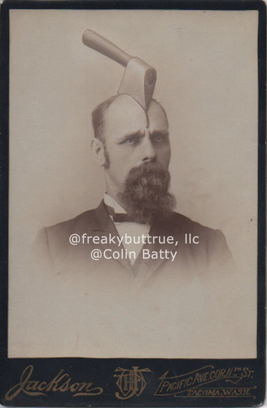 Original Cabinet Card - CC164 Hatchet in Guy's Head