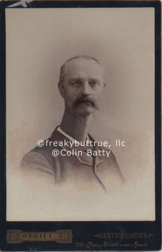 Original Cabinet Card - CC149 Long Neck Sad Man